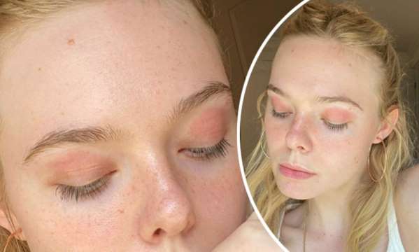 Elle Fanning's No-Makeup Selfie Shows off Her Eczema